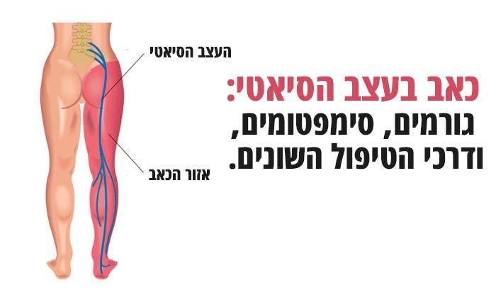 כאב בעצב הסיאטי: כל מה שאתם צריכים לדעת