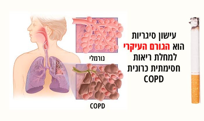 מחלת ריאות חסימתית כרונית COPD: תסמינים, גורמים ודרכי טיפול