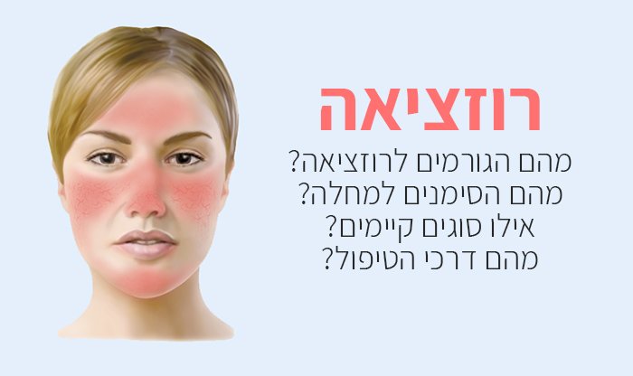 רוזציאה: גורמים, תסמינים ודרכי טיפול