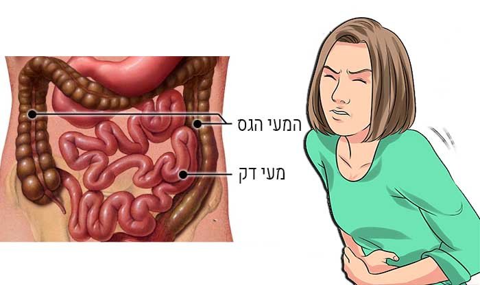 9 סימנים לתסמונת המעי הרגיז (IBS)