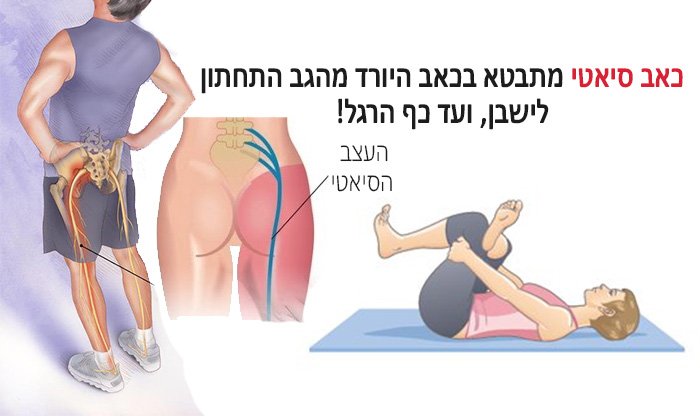 6 פתרונות יעילים לכאב בעצב הסיאטי