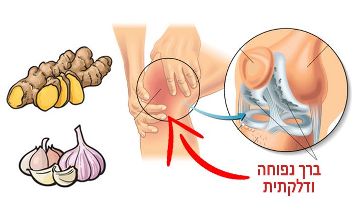 10 מזונות המסייעים בדלקות מפרקים