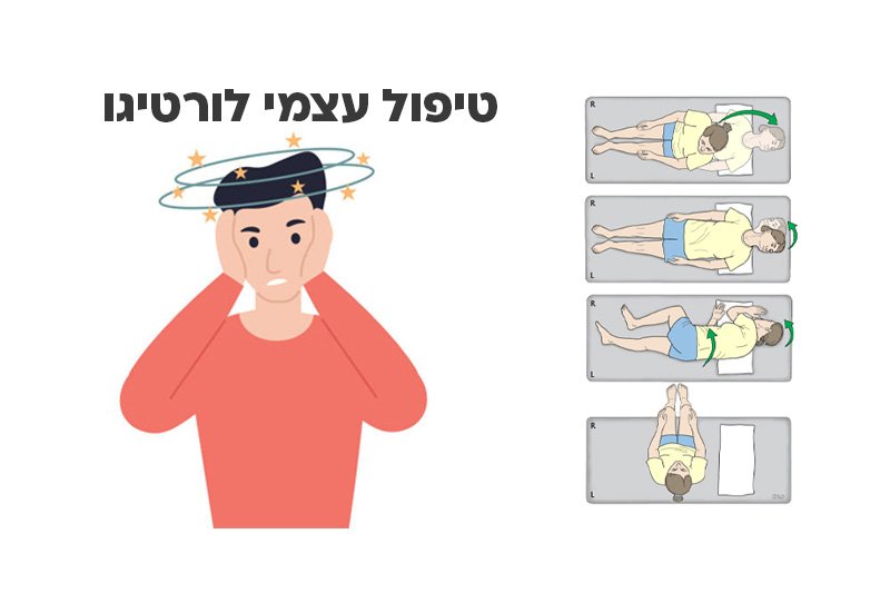 תמרון אפלי הביתי לטיפול בורטיגו