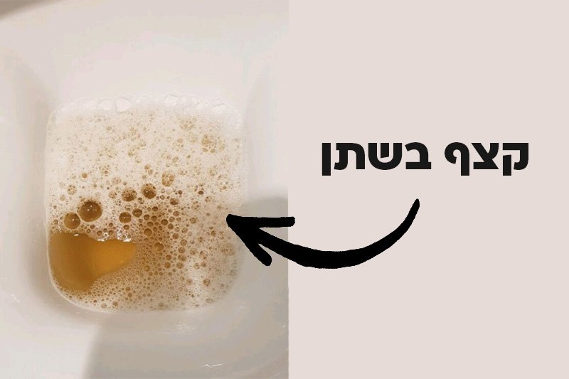 קצף בשתן – מה זה אומר?