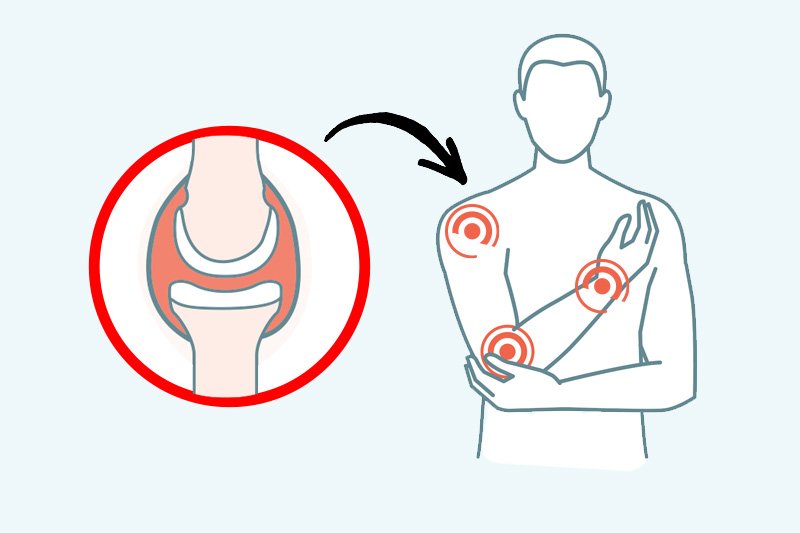 כאבי מפרקים – גורמים ודרכי טיפול
