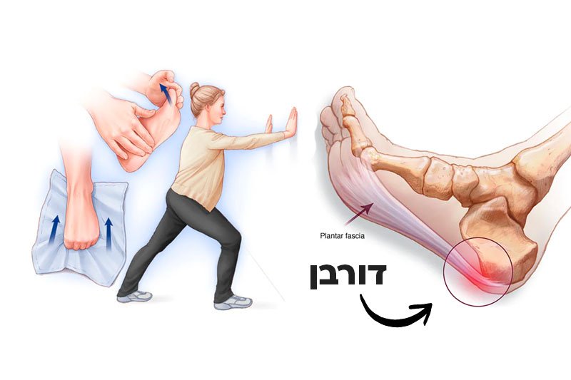 כאבים בעקב? כל הדרכים לטיפול בדורבן בכף הרגל