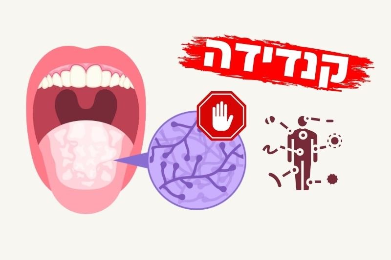 8 דרכים מוכחות לחיסול קנדידה אחת ולתמיד