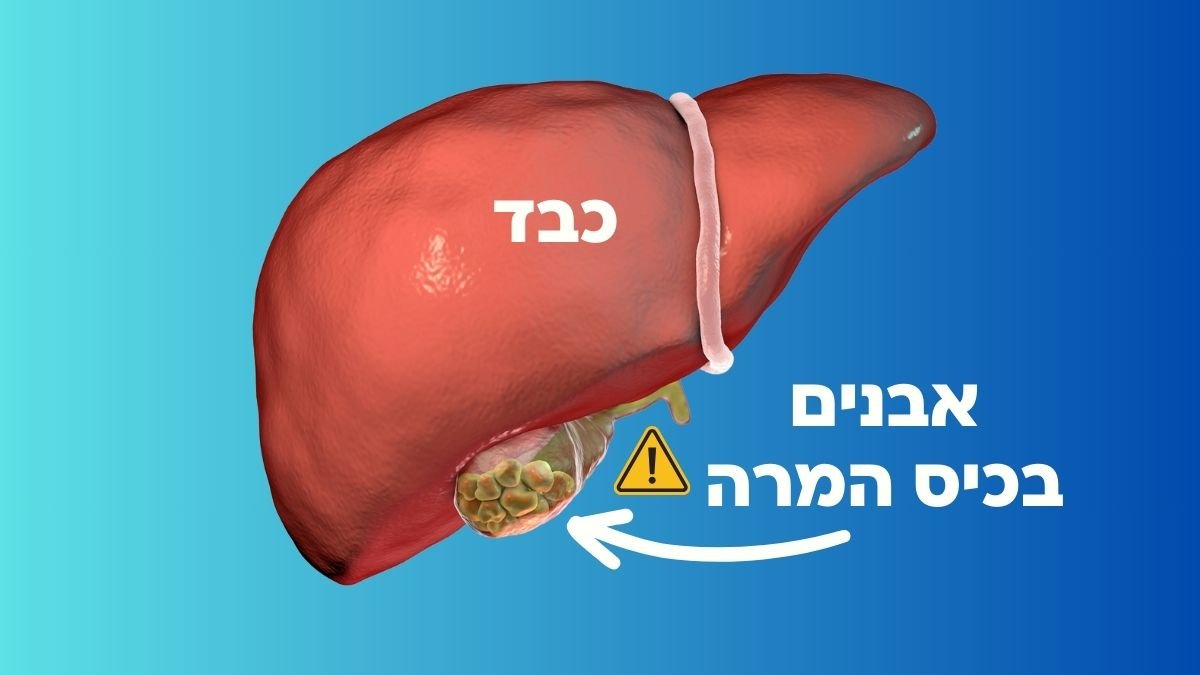 מהם הסימנים לאבנים בכיס המרה ואיך מטפלים במצב