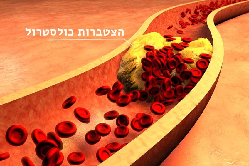 איך להפחית את הכולסטרול (ללא תרופות)