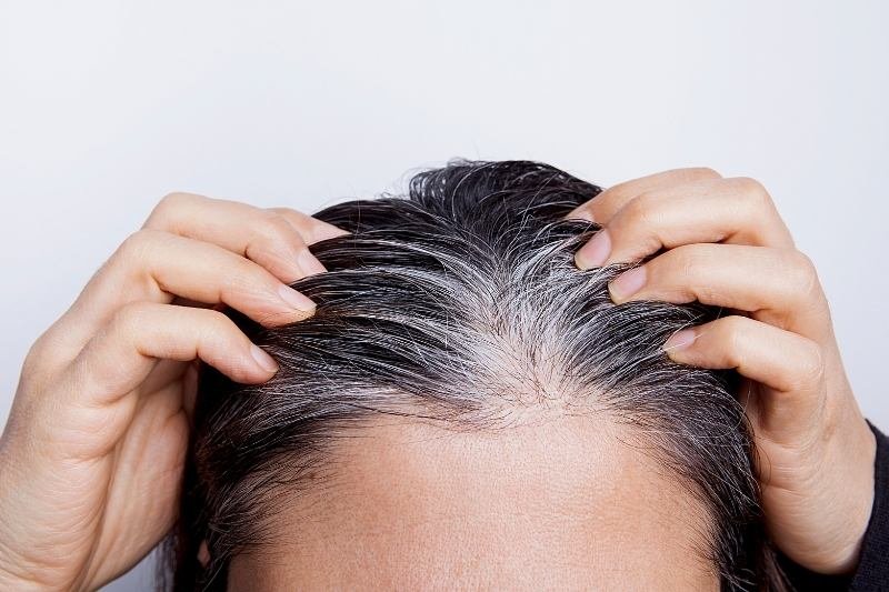 7 גורמים להופעה מוקדמת של שיער לבן