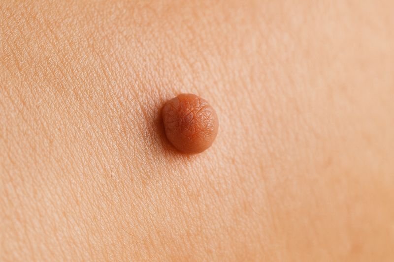 8 סימנים שיש לכם עמידות לאינסולין (טרום -סוכרת)