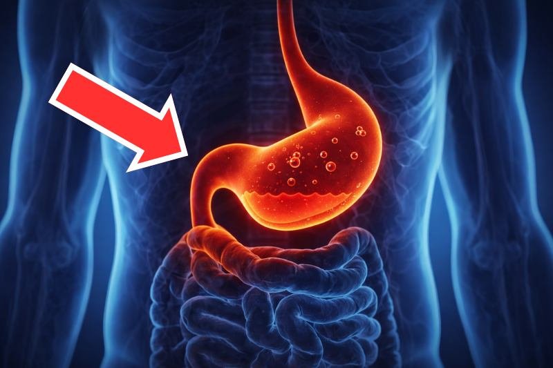 10 סימנים שחומציות הקיבה שלך נמוכה מדי (ולא גבוהה)